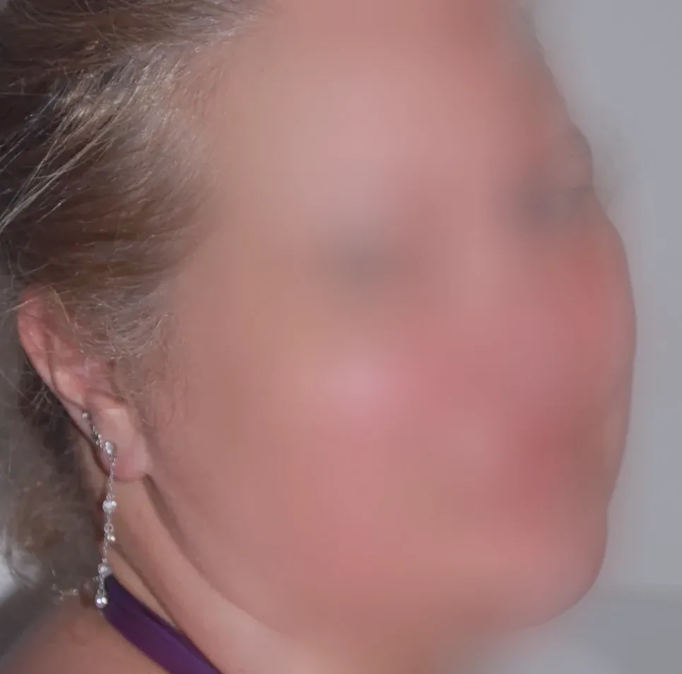 Hannah, 28